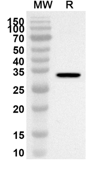 SLC25A5 Rabbit Polyclonal Antibody