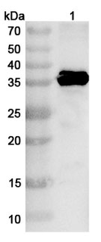 EV71 VP1/Capsid protein VP1 Rabbit Polyclonal Antibody