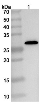 ASFV p72/B646L Rabbit Polyclonal Antibody