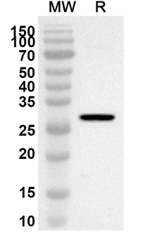 NTNG2/Netrin-G2 Rabbit Polyclonal Antibody