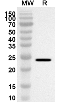 RGMA Rabbit Polyclonal Antibody