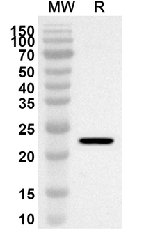 SFRP4 Rabbit Polyclonal Antibody
