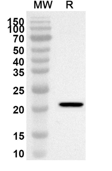 SGMS1 Rabbit Polyclonal Antibody
