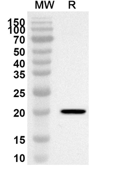 SORBS1 Rabbit Polyclonal Antibody