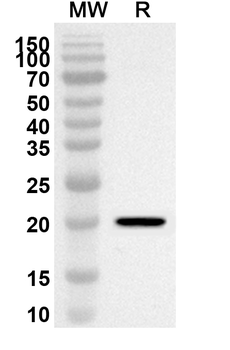 GPIHBP1 Rabbit Polyclonal Antibody