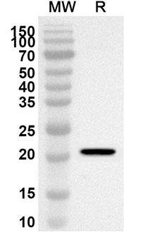 MCTS1 Rabbit Polyclonal Antibody