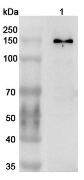 ATAD2 Rabbit Polyclonal Antibody