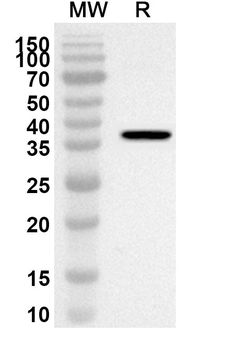 SLC18A2 Rabbit Polyclonal Antibody
