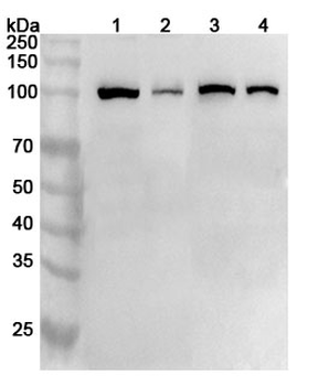 AP2B1 Rabbit Polyclonal Antibody