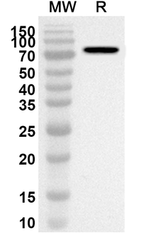 HPV18 L1/Major capsid protein L1 Rabbit Polyclonal Antibody