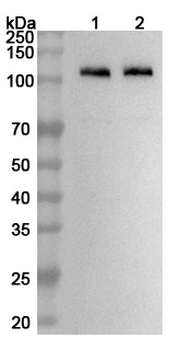 DPP6 Rabbit Polyclonal Antibody