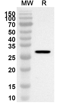 HIP1R Rabbit Polyclonal Antibody