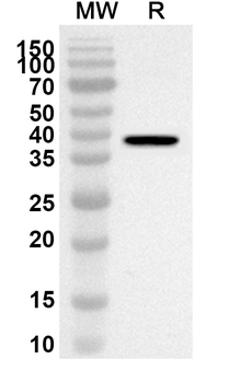 ATP5IF1 Rabbit Polyclonal Antibody