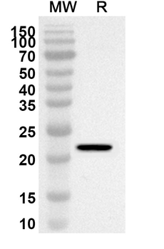LAMA5 Rabbit Polyclonal Antibody