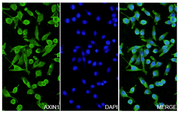 AXIN1 Rabbit Polyclonal Antibody