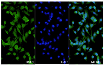 DSC2 Rabbit Polyclonal Antibody
