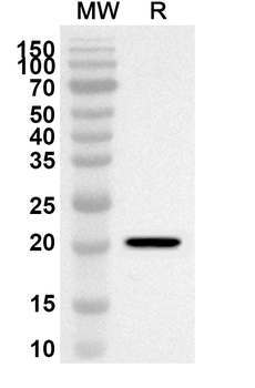 HLTF Rabbit Polyclonal Antibody
