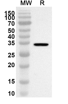 ANXA7 Rabbit Polyclonal Antibody