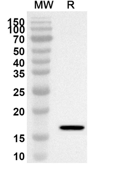 HNF1B Rabbit Polyclonal Antibody