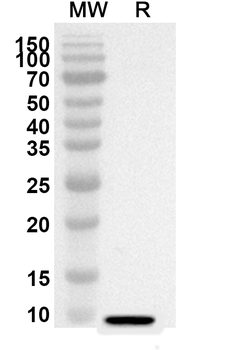 LRP5 Rabbit Polyclonal Antibody