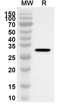 EPHA1 Rabbit Polyclonal Antibody