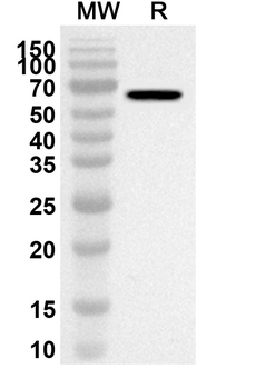 FBN2 Rabbit Polyclonal Antibody