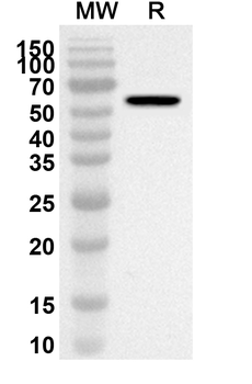 KRT20 Rabbit Polyclonal Antibody