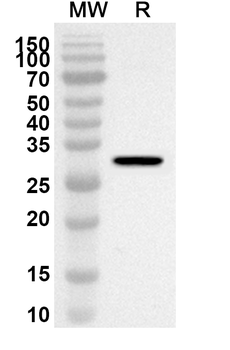 CA12 Rabbit Polyclonal Antibody