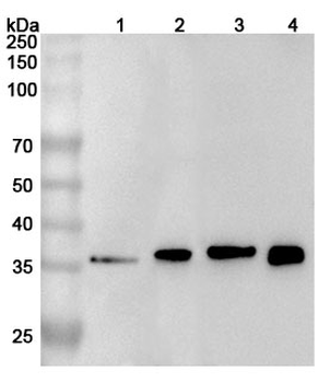 TREM2 Rabbit Polyclonal Antibody