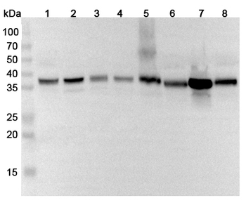 ALDOC Rabbit Polyclonal Antibody