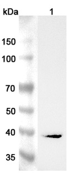 AGXT Rabbit Polyclonal Antibody