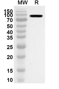MDM2 Rabbit Polyclonal Antibody