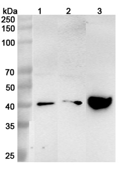 ASGR1 Rabbit Polyclonal Antibody