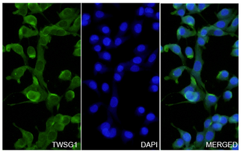 TWSG1 Rabbit Polyclonal Antibody