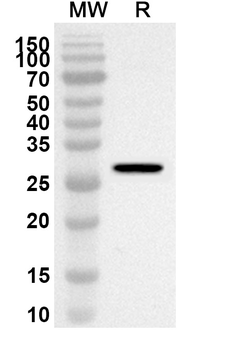 EXOSC8 Rabbit Polyclonal Antibody