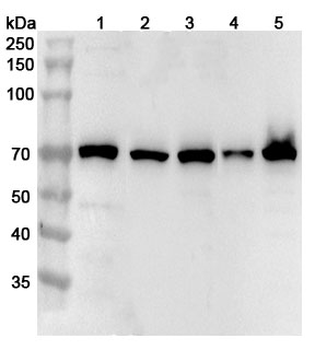 RIOK3 Rabbit Polyclonal Antibody
