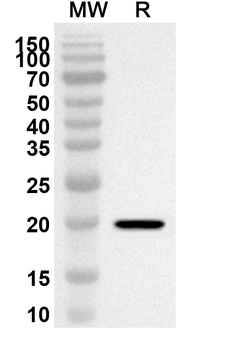 STMN3 Rabbit Polyclonal Antibody