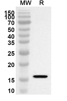 HES5 Rabbit Polyclonal Antibody
