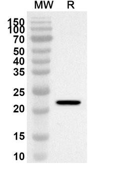 TIMM9 Rabbit Polyclonal Antibody