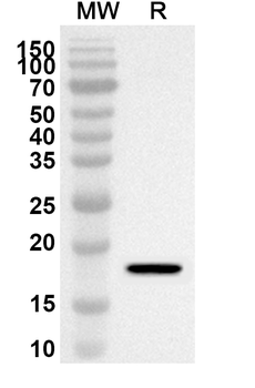 UFL1 Rabbit Polyclonal Antibody
