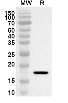 EIF5A2 Rabbit Polyclonal Antibody