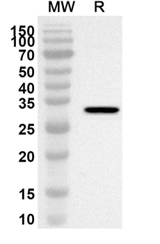 PTPA Rabbit Polyclonal Antibody