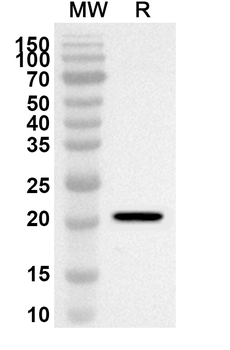 HOXA9 Rabbit Polyclonal Antibody