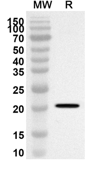 PPP3R2 Rabbit Polyclonal Antibody