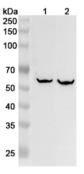FTCD Rabbit Polyclonal Antibody