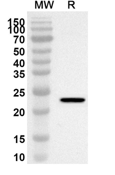 ADI1 Rabbit Polyclonal Antibody