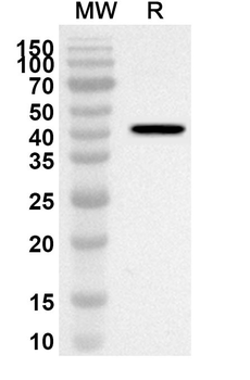 GTPBP4 Rabbit Polyclonal Antibody