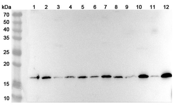 RPL22 Rabbit Polyclonal Antibody