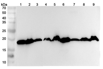 RPL23A Rabbit Polyclonal Antibody