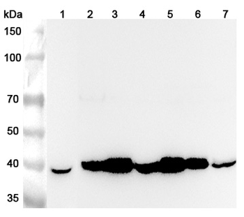 GNAQ Rabbit Polyclonal Antibody